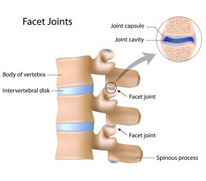 Medial Branch Nerve Block