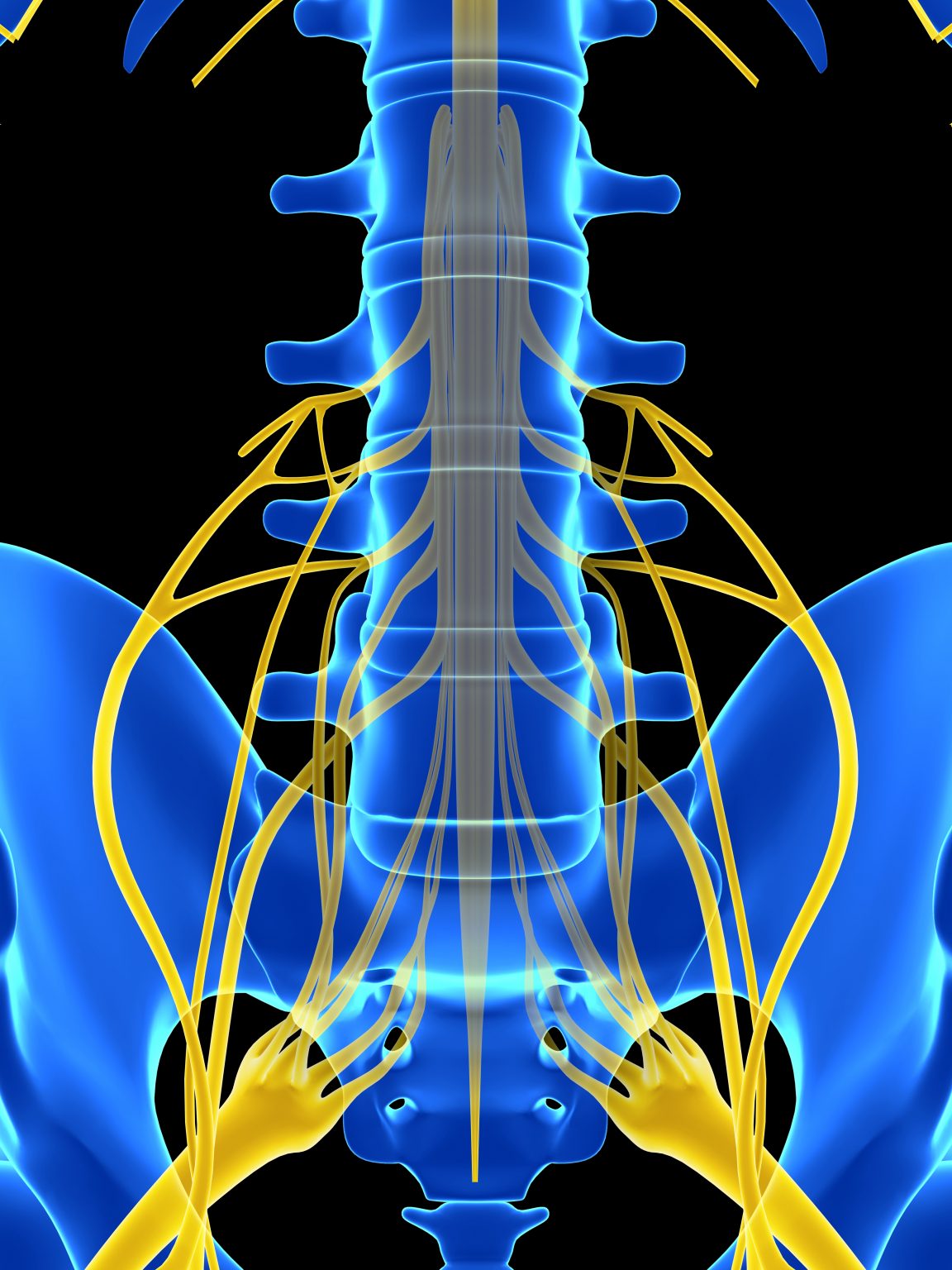 spinal stimulator dorsal column myelopathy causing