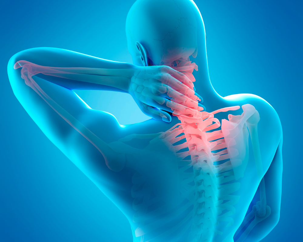 Top 3 Benign Causes of Neck Pain and How to Address Them