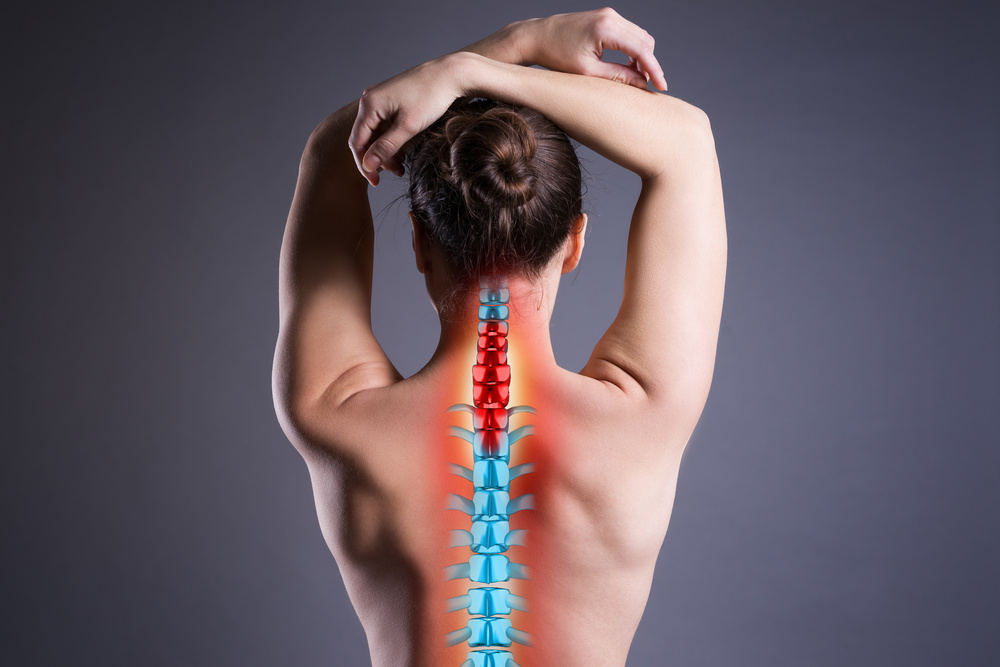 Is It Possible to Have Cervical Kyphosis Without Any Symptoms